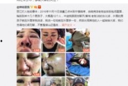 爆料博主毁容事件视频播放