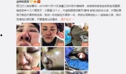 爆料博主毁容事件视频播放